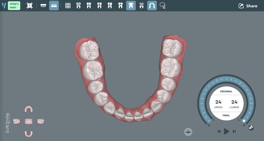 下顎イメージ画像